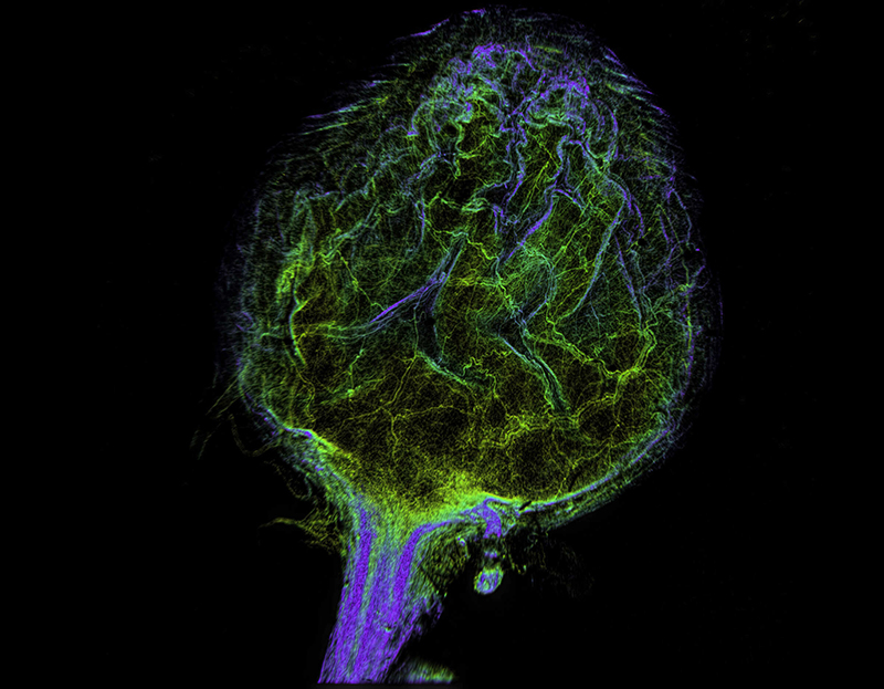 使用2X Plan Apochromat物镜，以8192×8192像素、iDISCO透明化小鼠的完整膀胱图像。有效像素大小：0.6 µm（普通黑白CMOS摄像头5倍以上的空间分辨率）